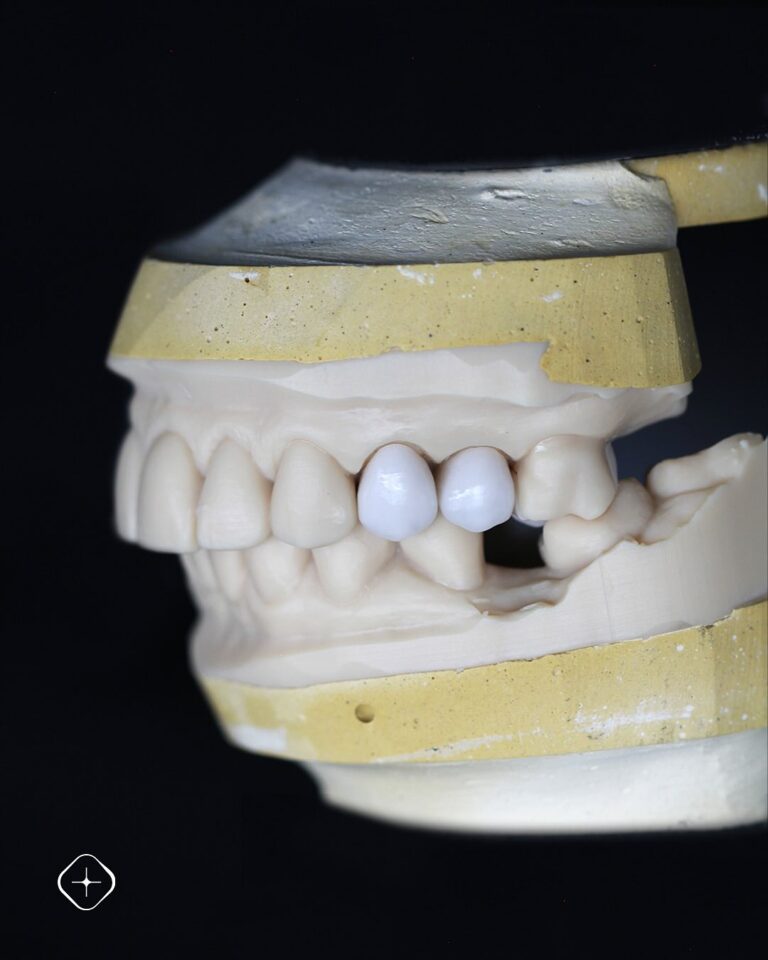 Capacitados para solucionar cualquier caso. #DedicadosALaPrecisión #LaboratorioDental (1)