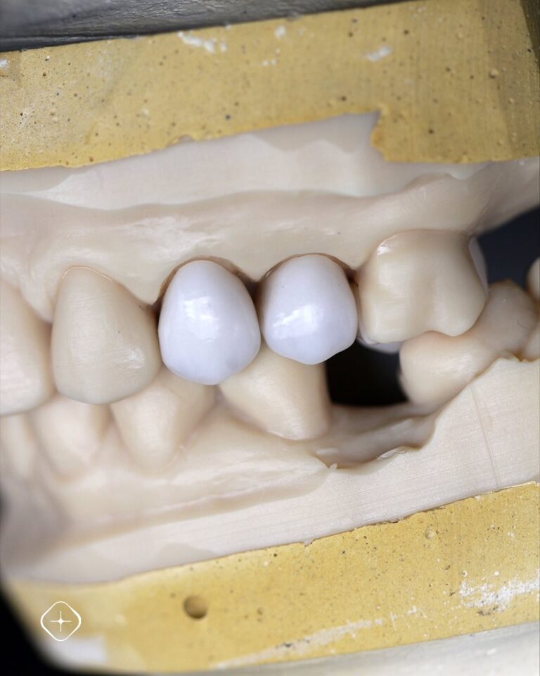 Capacitados para solucionar cualquier caso. #DedicadosALaPrecisión #LaboratorioDental