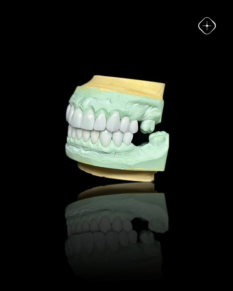 La excelencia de nuestro trabajo está en los detalles. ✨ #DedicadosALaPrecisión (1)