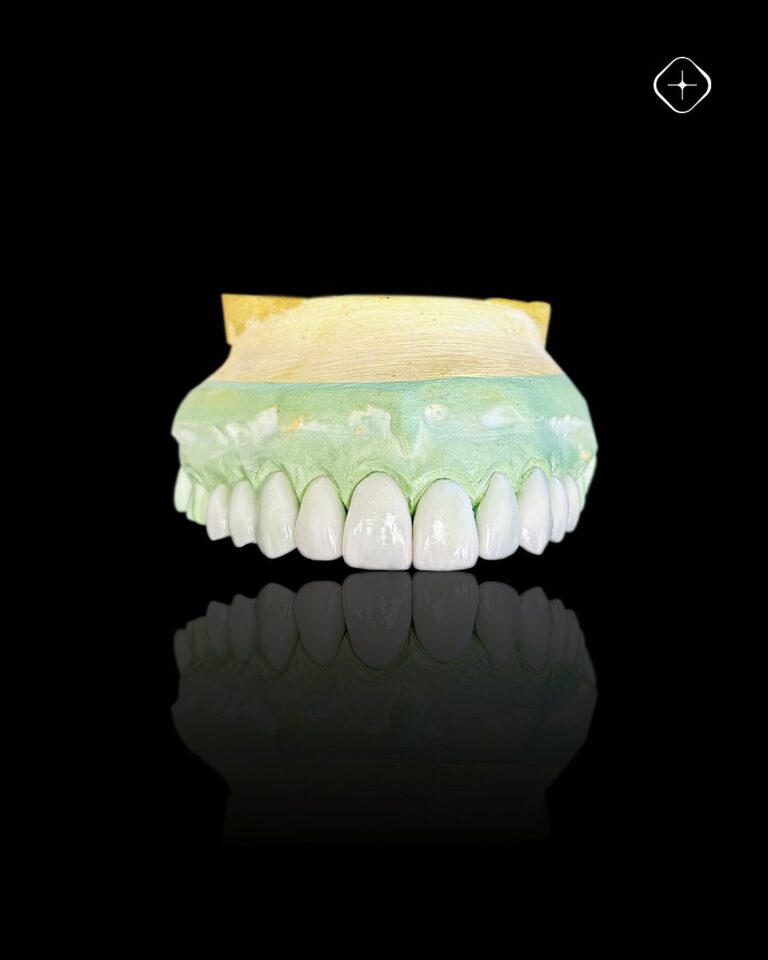 La excelencia de nuestro trabajo está en los detalles. ✨ #DedicadosALaPrecisión (3)