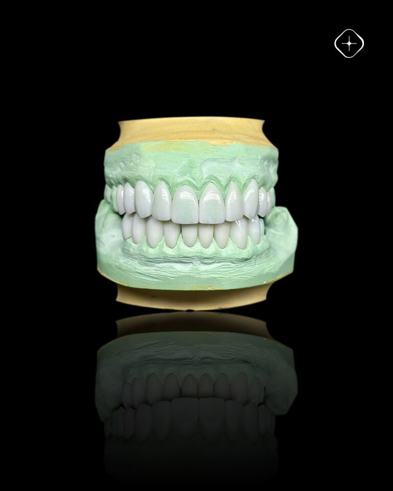 La excelencia de nuestro trabajo está en los detalles. ✨ #DedicadosALaPrecisión