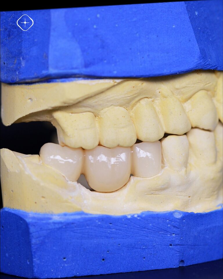 Nos especializamos en casos que emulan la naturaleza con detalle. ✅ Recolectamos y entregamos en (1)