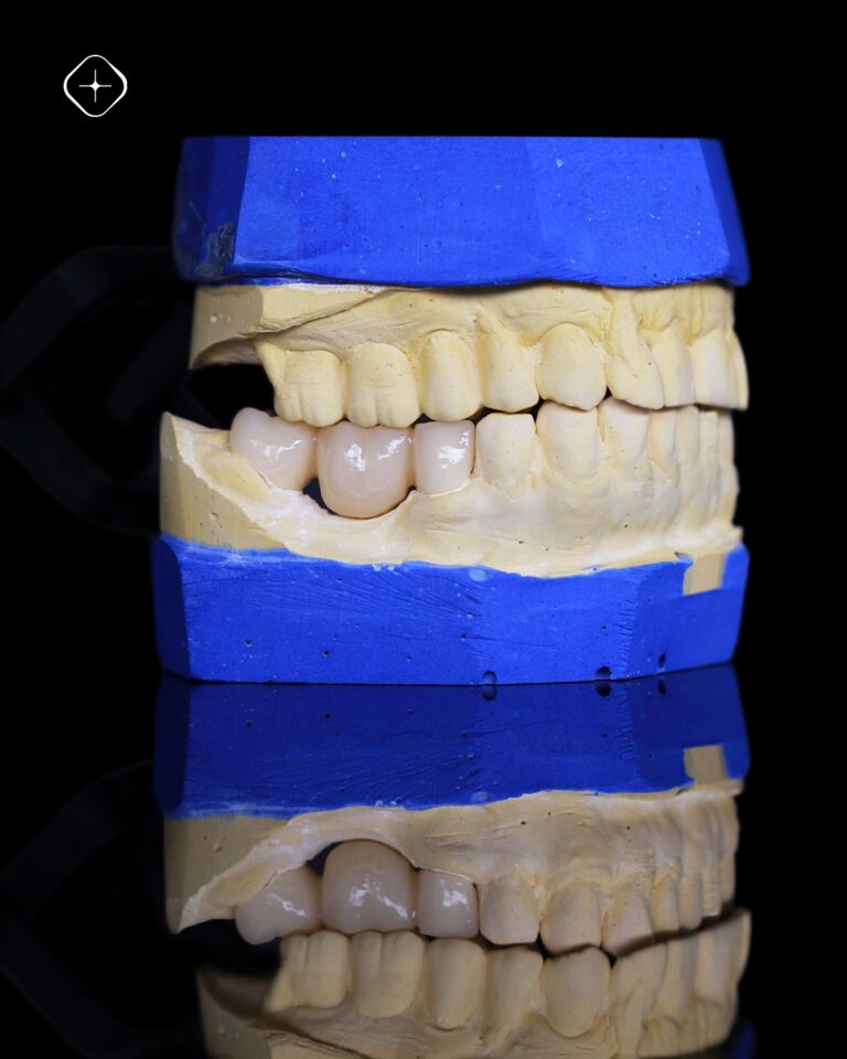 Nos especializamos en casos que emulan la naturaleza con detalle. ✅ Recolectamos y entregamos en