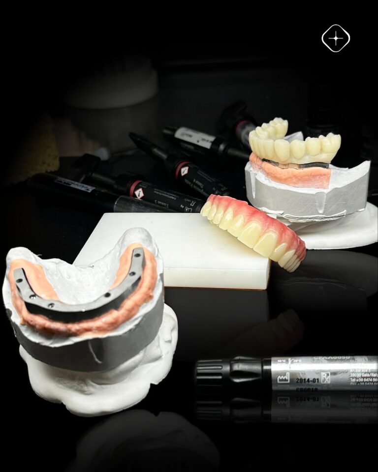 🦷 Prótesis híbrida sobre barra de titanio, fabricadas en Prime Multistratum® y estratificadas c (3)